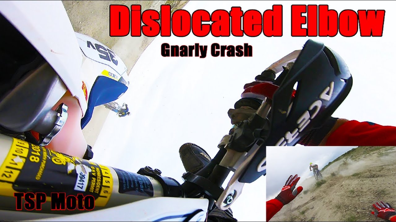 Dislocated Elbow Gnarly Crash Lance Walker Memorial Desert Race Lyman WY