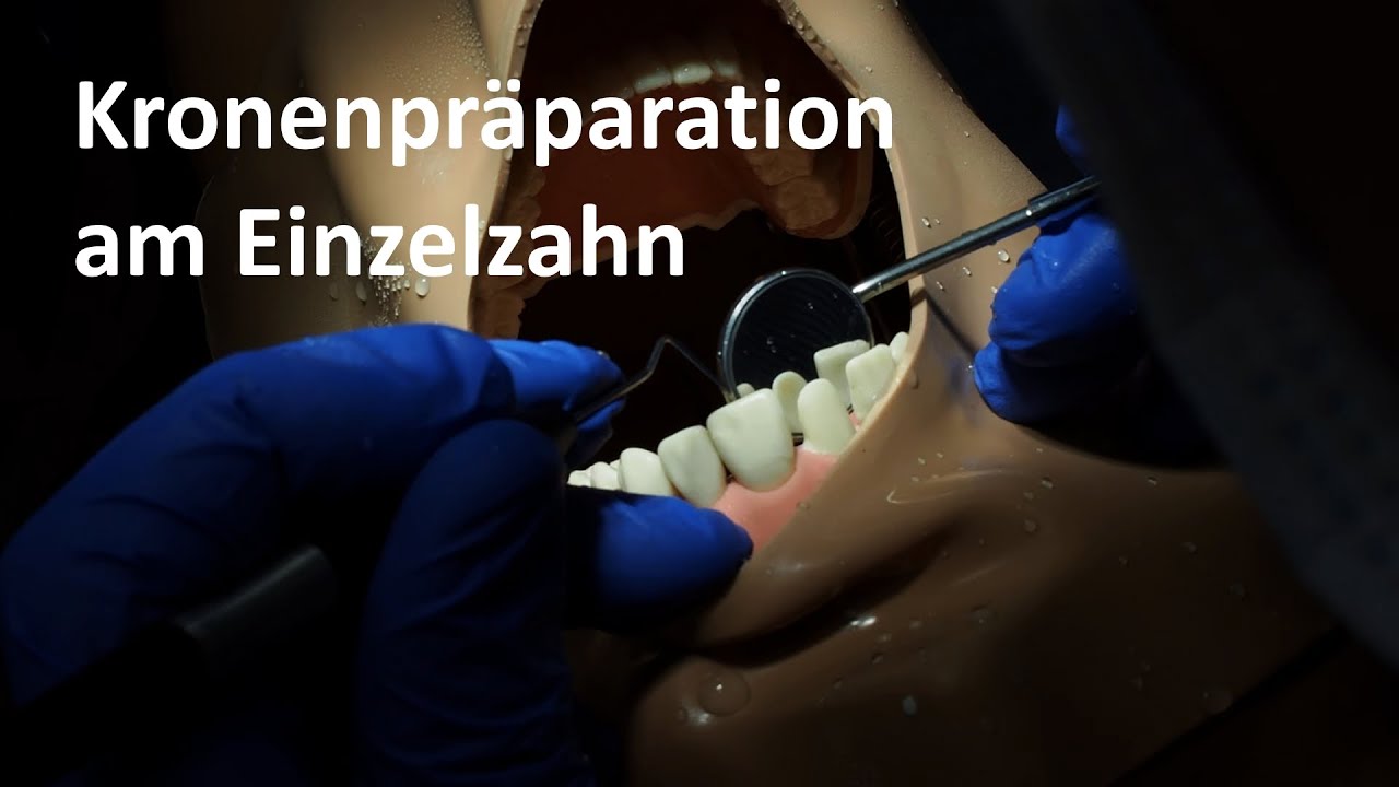 Kronenpr&auml;paration I: Kronenpr&auml;paration am Einzelzahn [4K]
