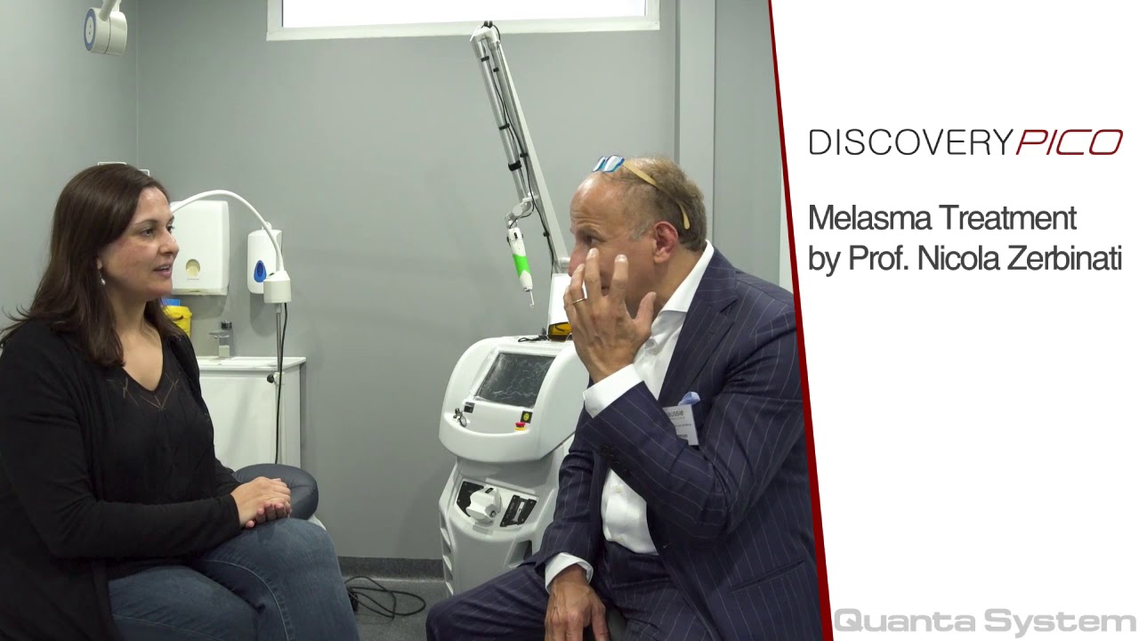 Melasma Treatment using the Discovery Pico By Prof.Nicola Zerbinati