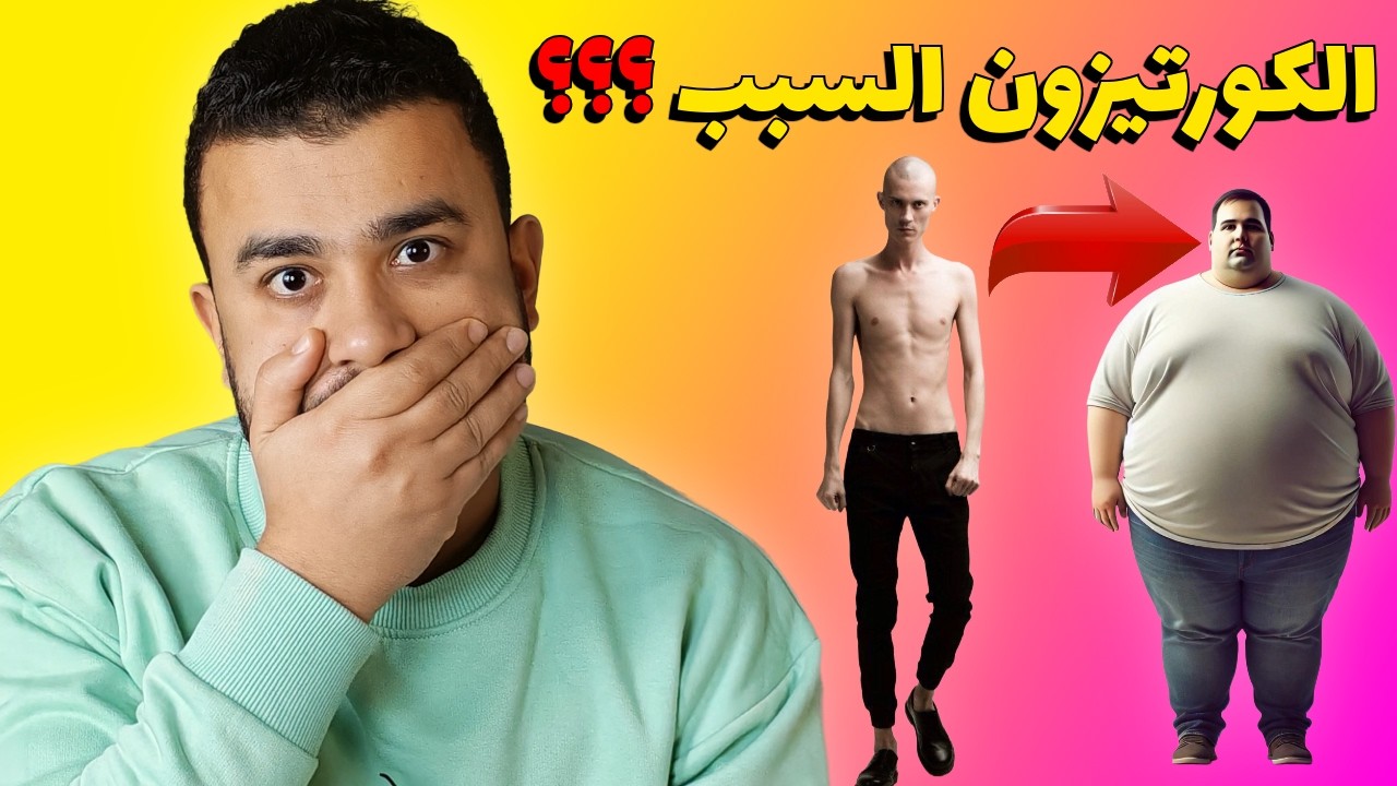 الكورتيزون وزيادة  الوزن .. احذر قبل فوات الأوان