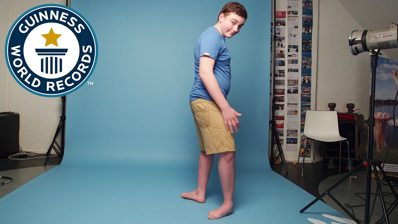 Teenager can make his feet face backwards - Guinness World Records