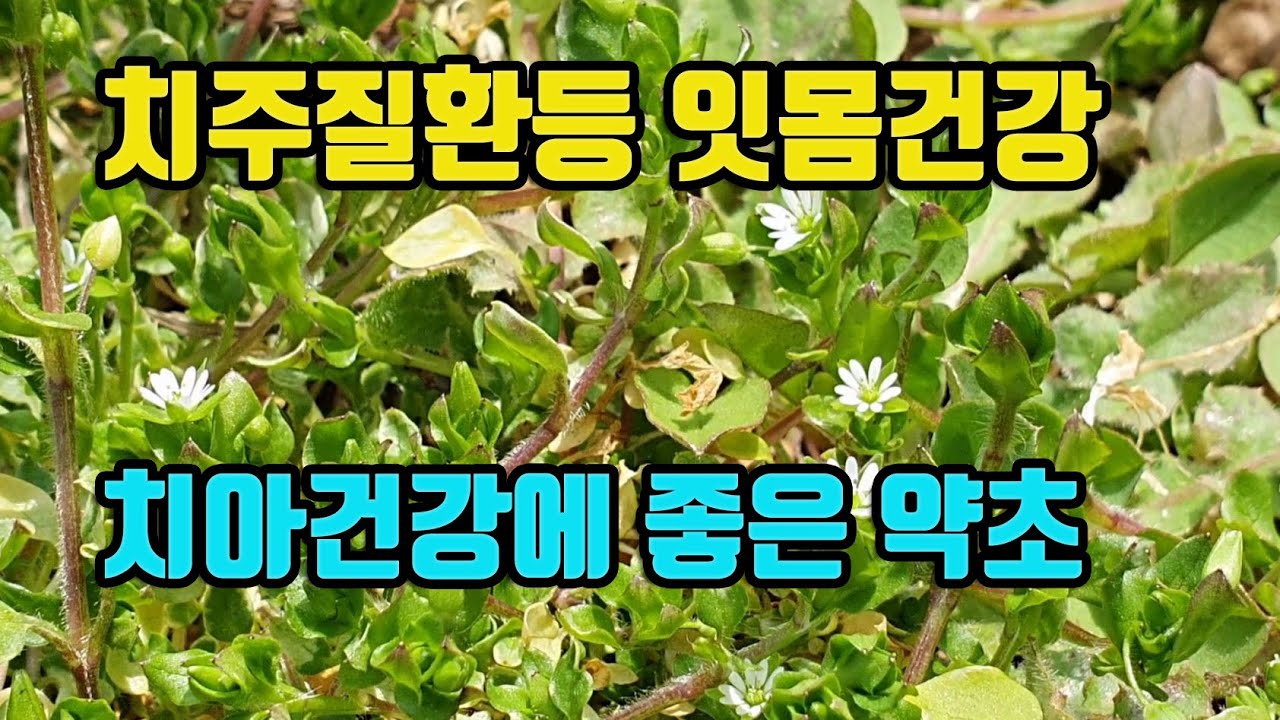 별꽃-장수하려면 치아와 잇몸이 좋아야한다! 잇몸병과 치아건강에 탁월한 약초! 치은염, 치조농루등 잇몸질환, 이가 흔들리는 증상, 치통이 사라진다, 뇌질환과 치매에도 효능이 있다