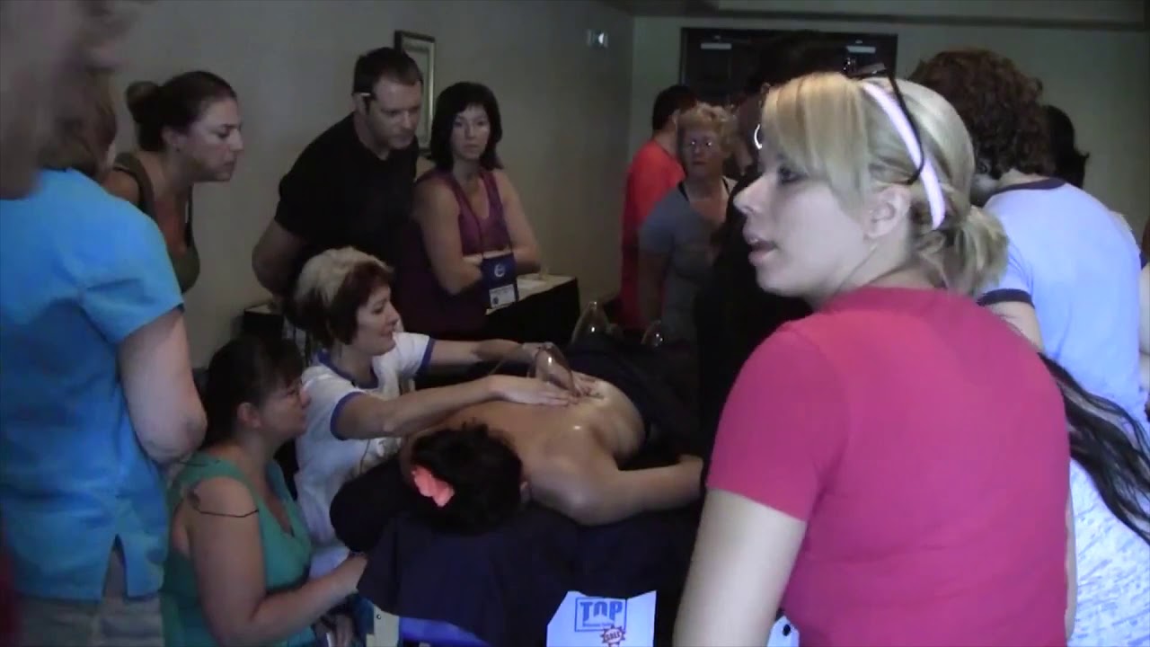 Discovery with Cupping Therapy - Cupping Therapy Workshop Demo Part 2