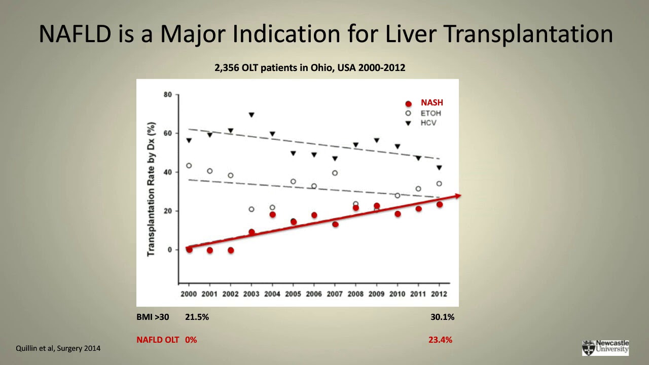AASLD 2018 Update: Advancing Role of NITs in Liver Disease