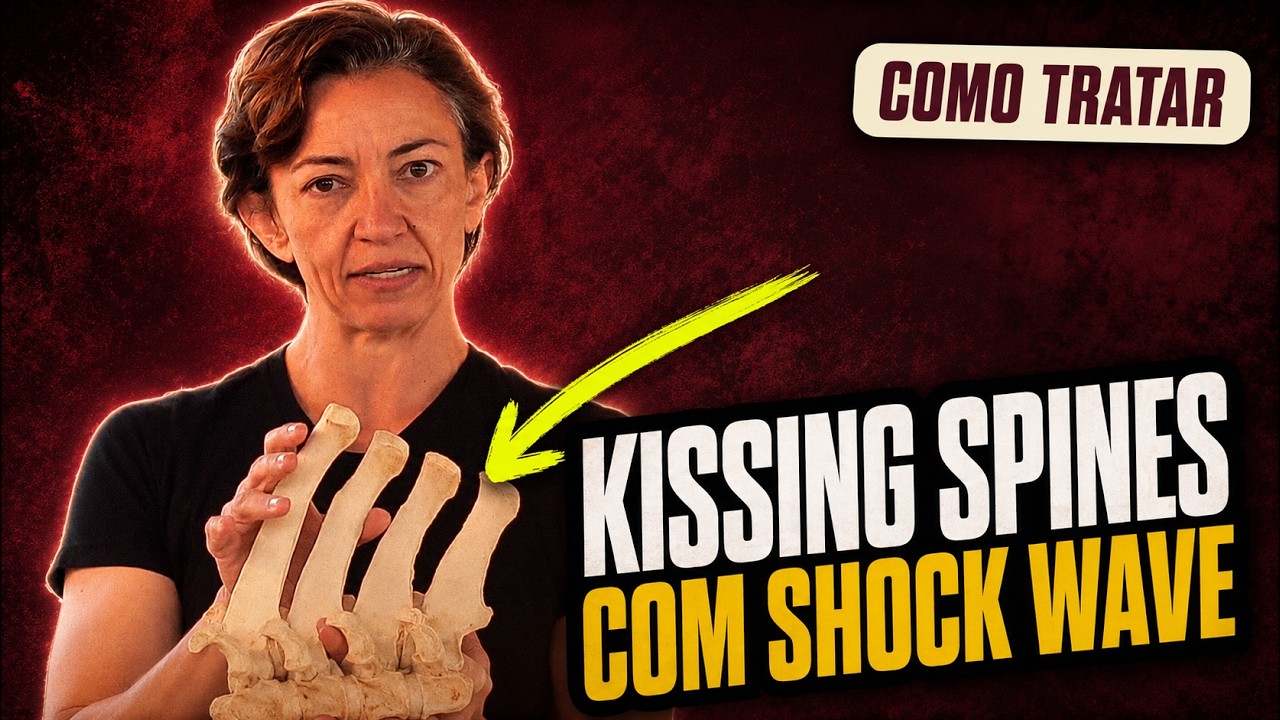 Saiba como posicionar a probe do Shock wave para tratar efetivamente o kissing spines nos cavalos