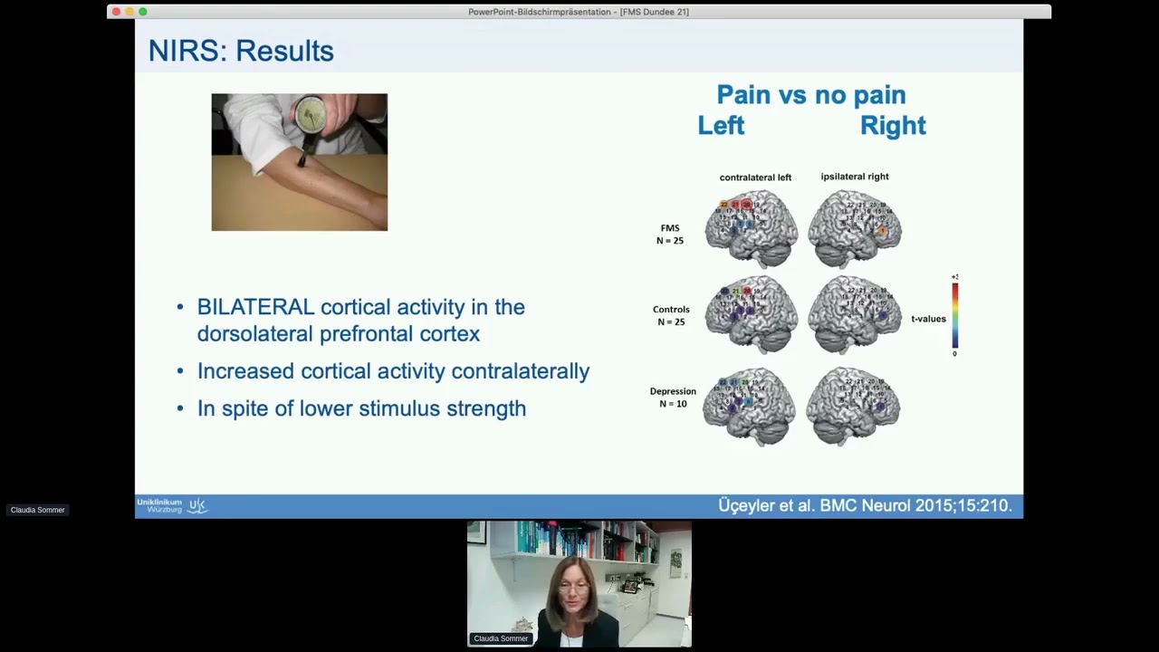Session 4B, Claudia Sommer and End: Scottish Pain Research Community 2021 Annual Scientific Meeting
