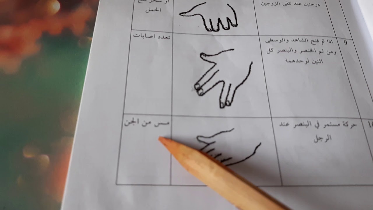 تشخيص حالة المريض بعلم الإشارات0032479102091