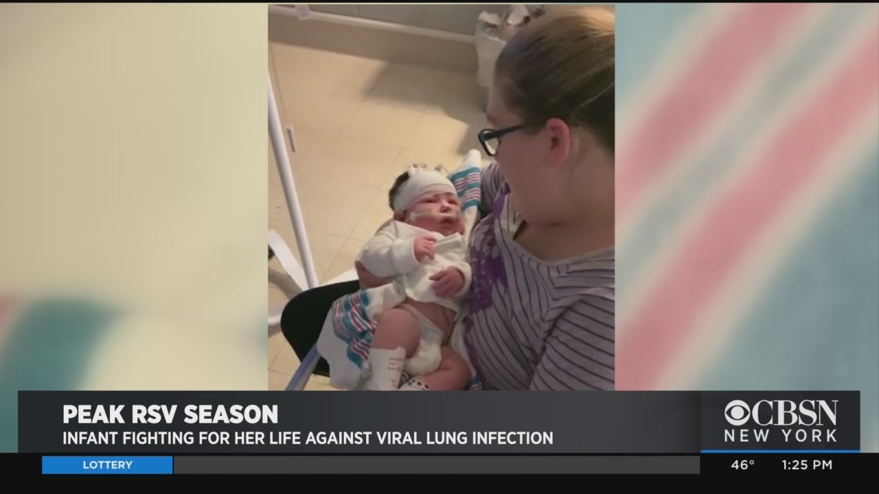 4-Week-Old Fighting For Her Life Against Lung Infection