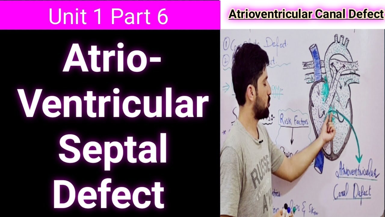 atrioventricular septal defect | avsd symptoms, pathophysiology and complications | avsd repair