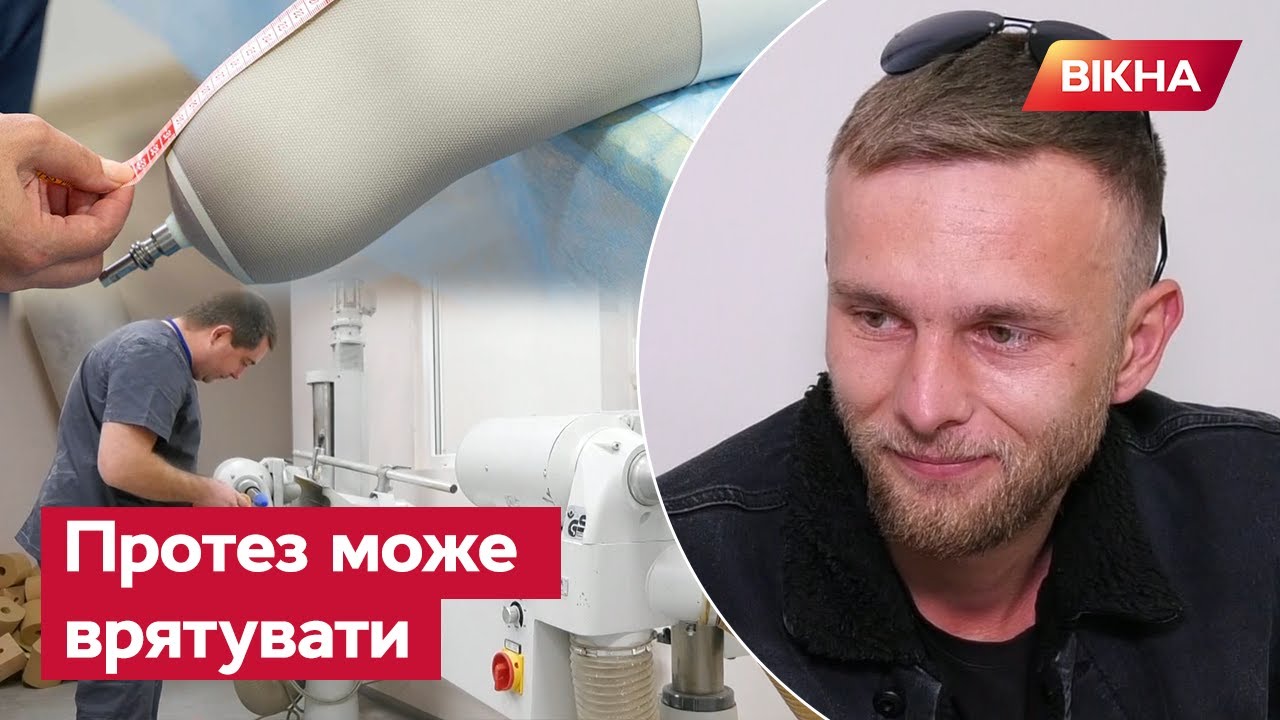 Вони ВТРАТИЛИ СВОЇ КІНЦІВКИ: як проводять протезування в Одесі
