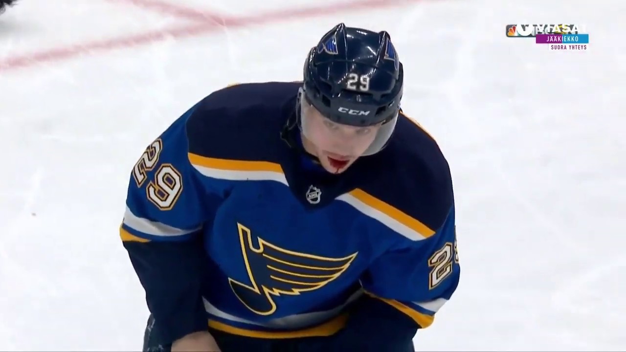 Vince Dunn saa kiekon kasvoihin (SJS vs STL)