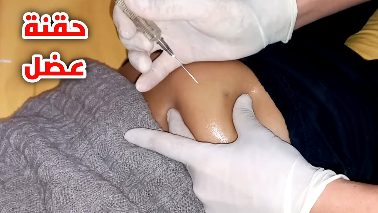 تعلم اعطاء الحقن العضل في المنزل او المستشفي (تطبيق عملي)_ Intramuscular injection at home
