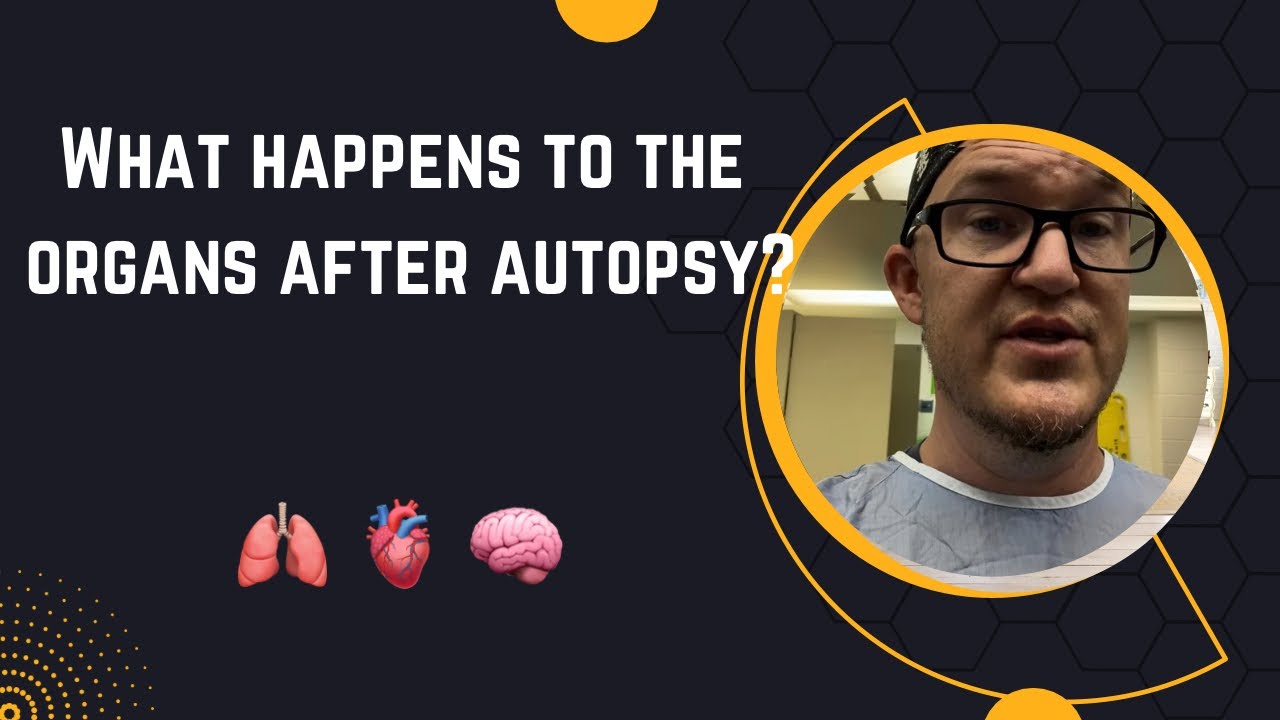 What Happens To The Organs After Autopsy? #autopsy #forensics #doctor