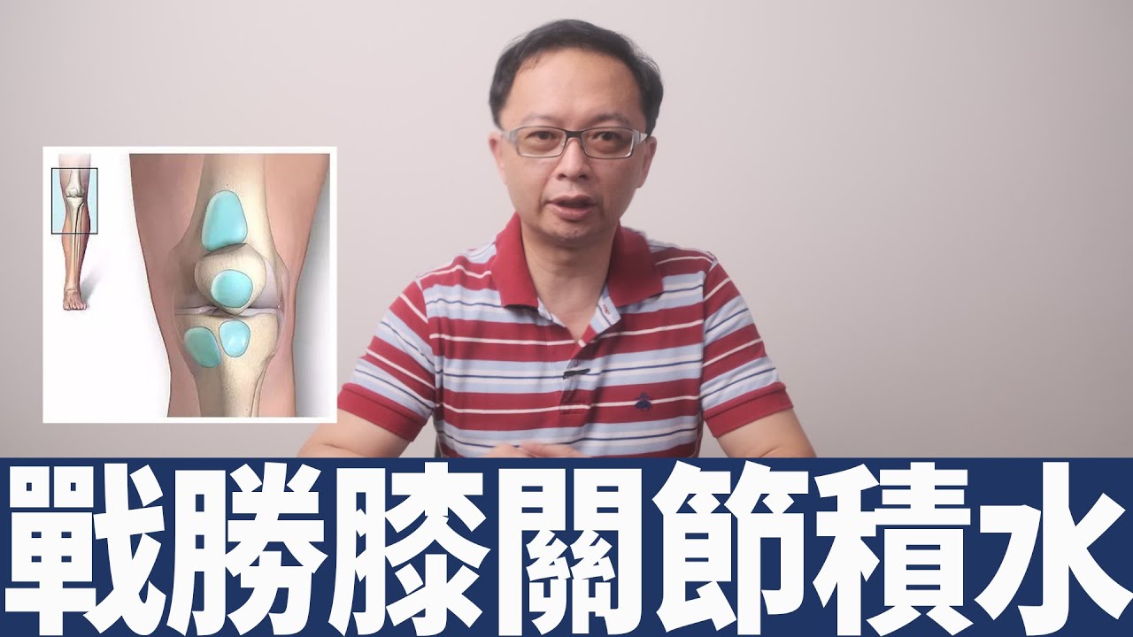 【管家膝】膝關節積水怎麼辦?!