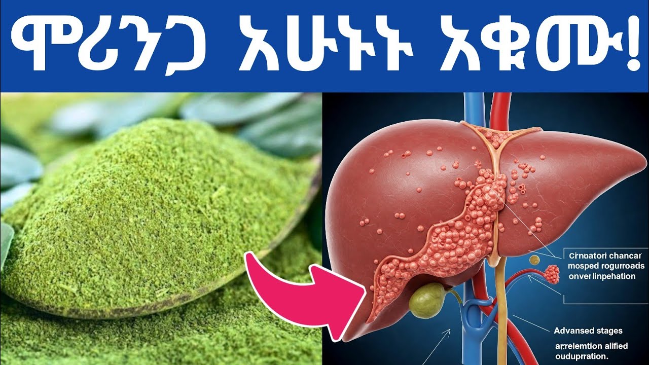ከመጠን በላይ ሞሪንጋ መጠቀም የሚያስከትለው የጤና ጉዳትና በቀን ምን ያክል መጠቀም አለባችሁ| Side effects of using too much moringa