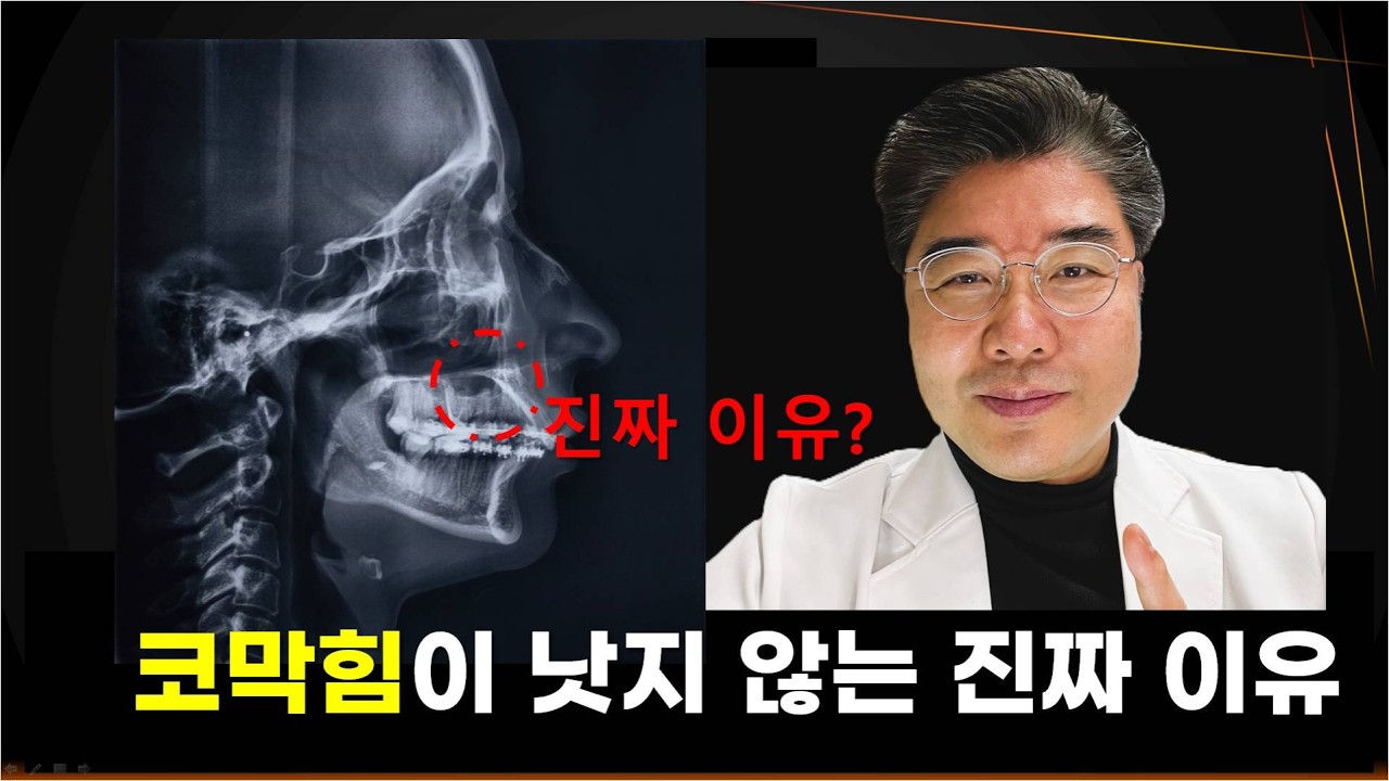 비염이 낫지 않는 진짜 이유 (스탠포드 대학교 연구 포함)