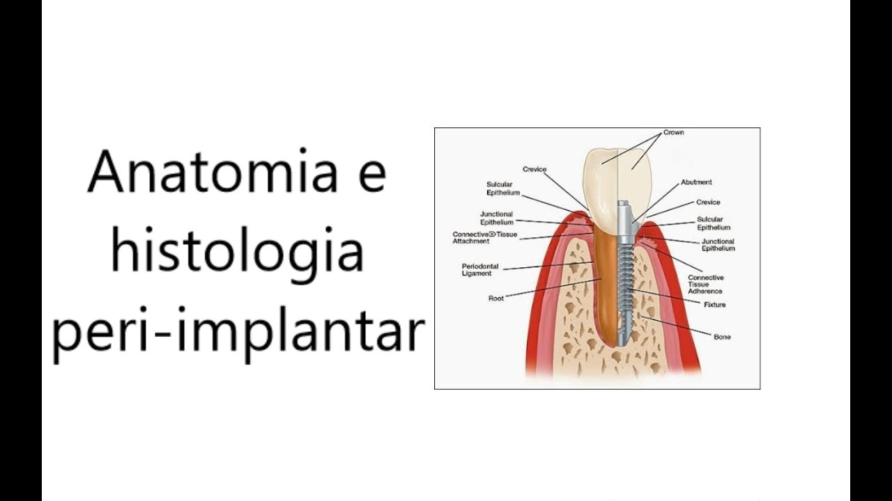Anatomia e histologia periimplantar