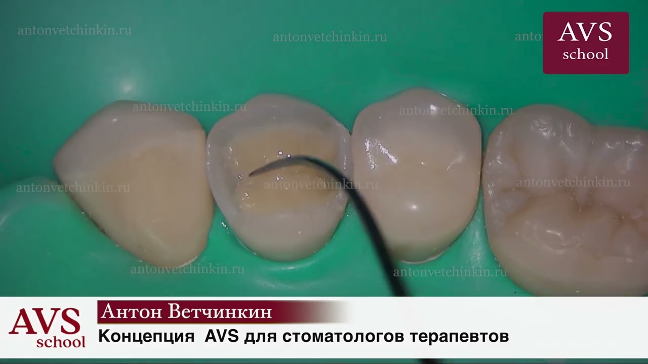 О концепции AVS