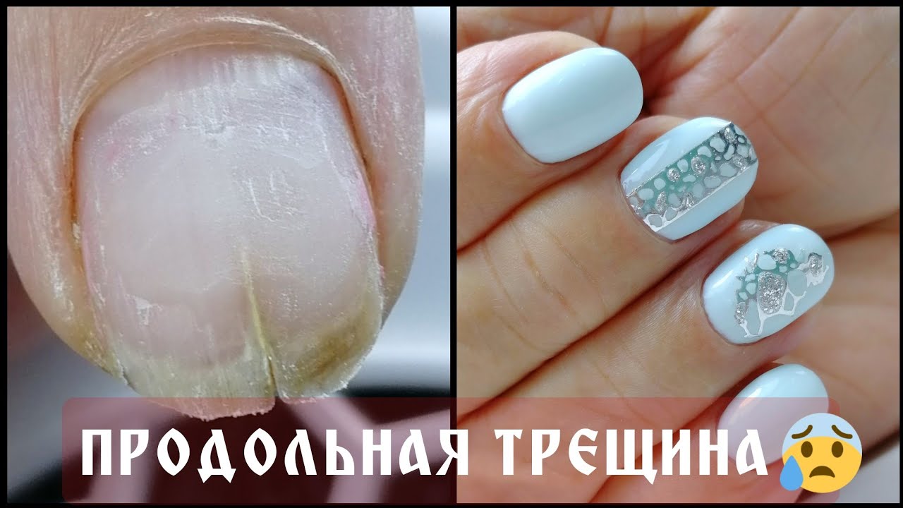 ПРОДОЛЬНАЯ ТРЕЩИНА ногтя ОПЯТЬ😱/ремонт полигелем👍/СРЕЗ кутикулы❤️/нежный маникюр Rosalind MACARON💎