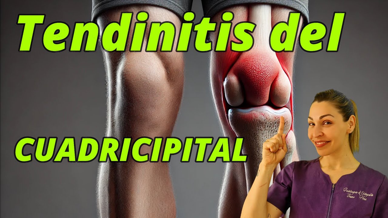 🟣TENDINITIS CUADRICIPITAL🦵🏼, Tratamiento real de la RODILLA/#fisioterapia,masaje y ondas de choque🔝