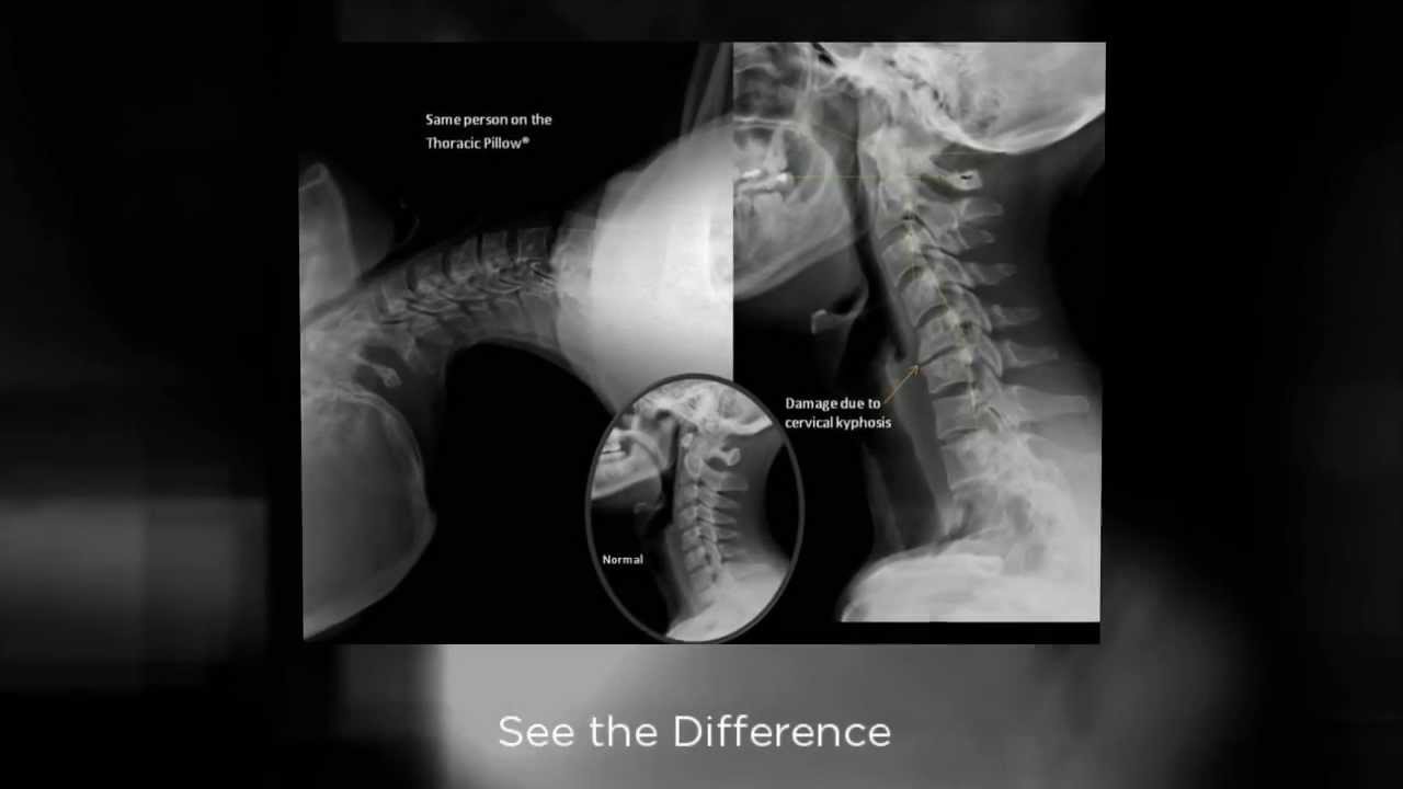 Thoracic Pillow&reg; - Posture Correction Device - Dr Posture&reg;