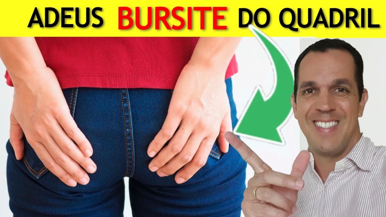 BURSITE NO QUADRIL - VEJA ESSE TRATAMENTO NATURAL