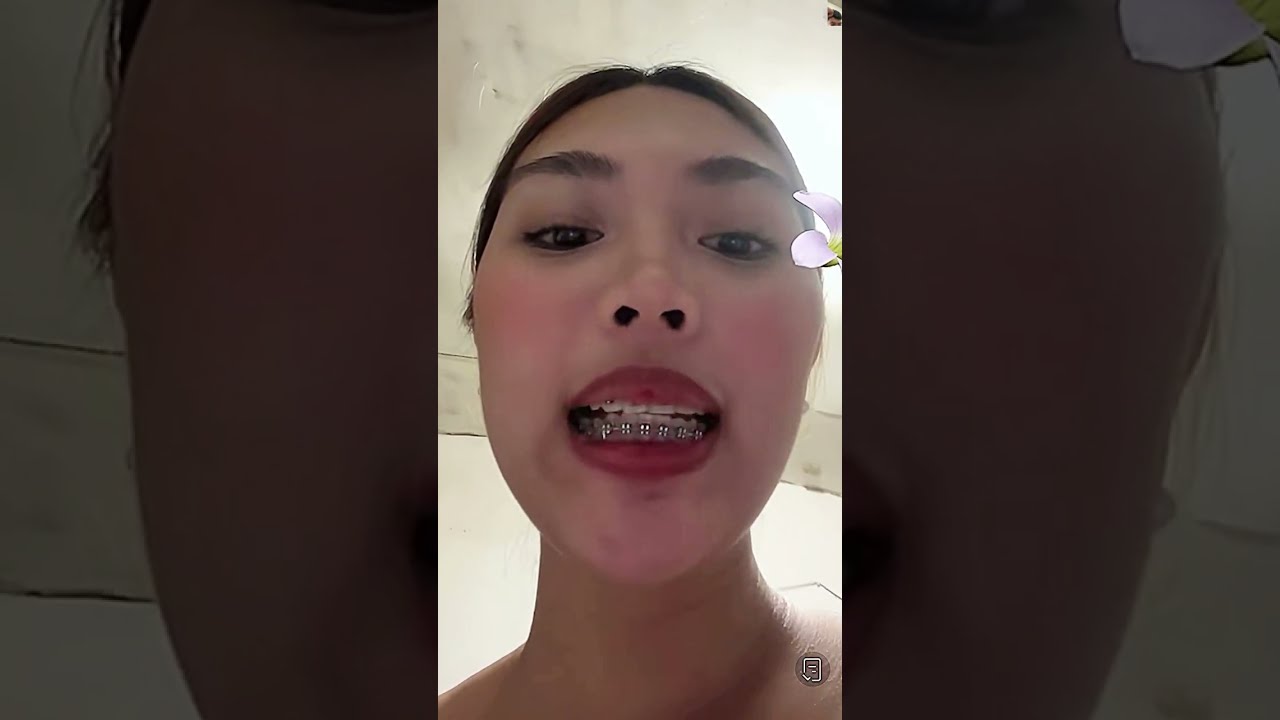 Periscope live broadcast_271