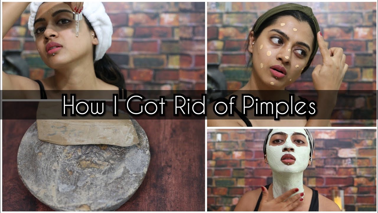 5 Good Habits of People Who got Rid of Acne | SuperWowStyle Prachi