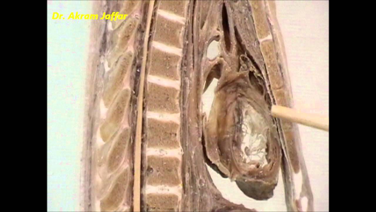 Сагиттальные срезы грудной клетки