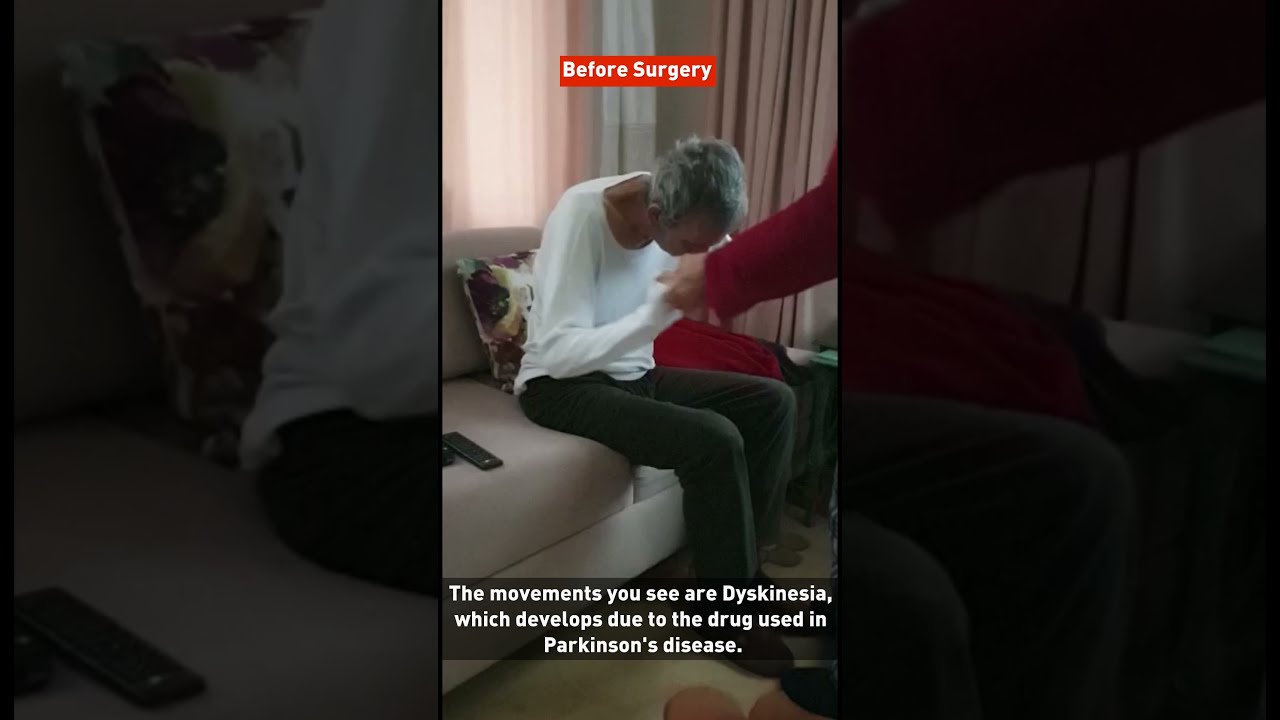 Dyskinesia which seems in Parkinson's disease respond well to Deep Brain Stimulation treatment.