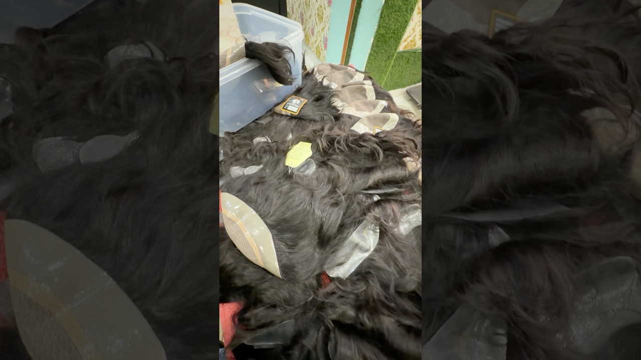 Hair patch in Kolkata.best hair patch salon in Kolkata.natural hair. Human hair patch