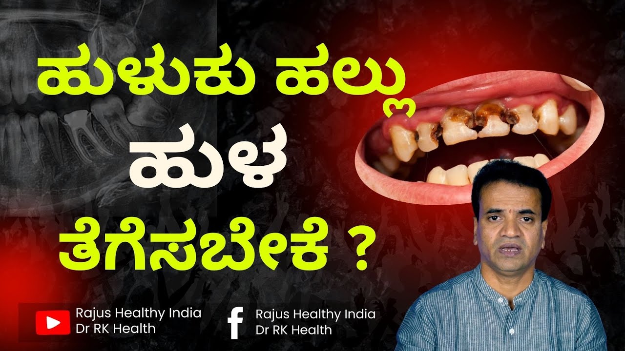 ಹುಳುಕು ಹಲ್ಲು  ಹುಳತೆಗೆಸಬೇಕೆ ?