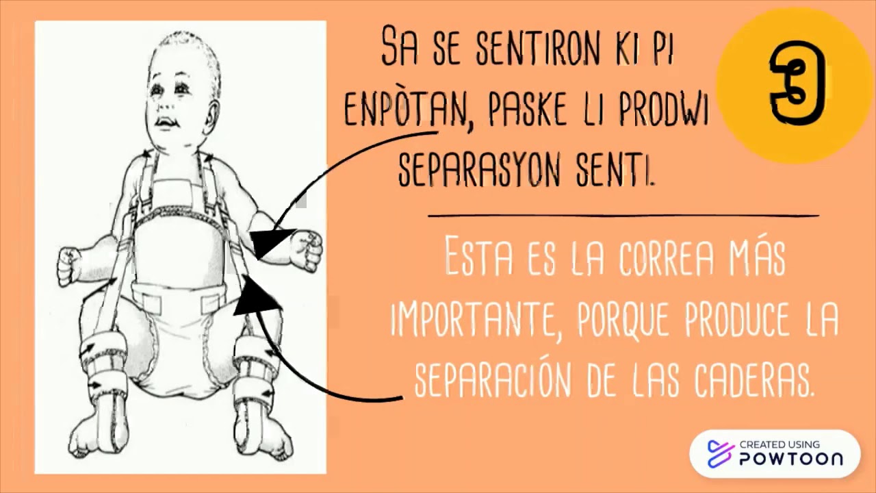 15 consejos para el buen uso de las correas de Pavlik en displasia de cadera”