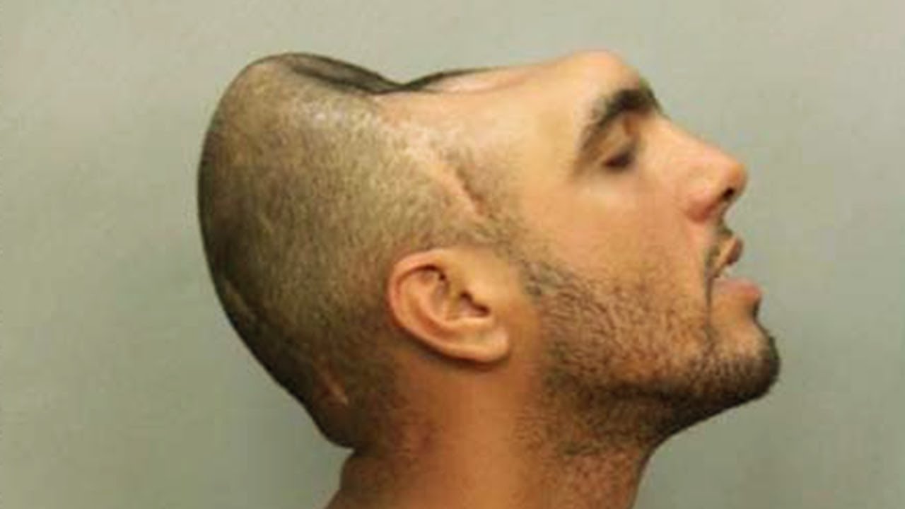 Top 10 Fascinating Stories Of People Who Survived The Impossible