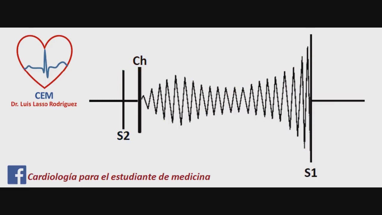 auscultacion soplo de estenosis tricuspidea