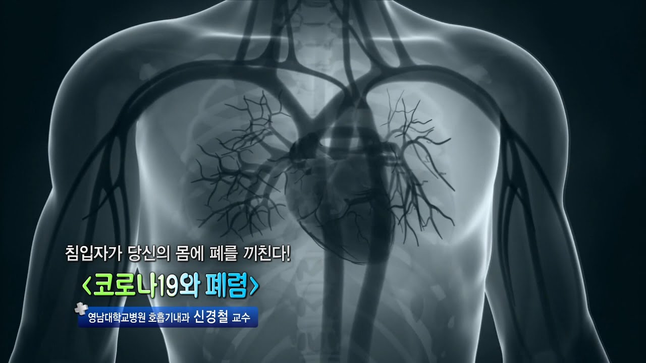 코로나19와 폐렴 - 영남대학교병원 호흡기내과 신경철 교수