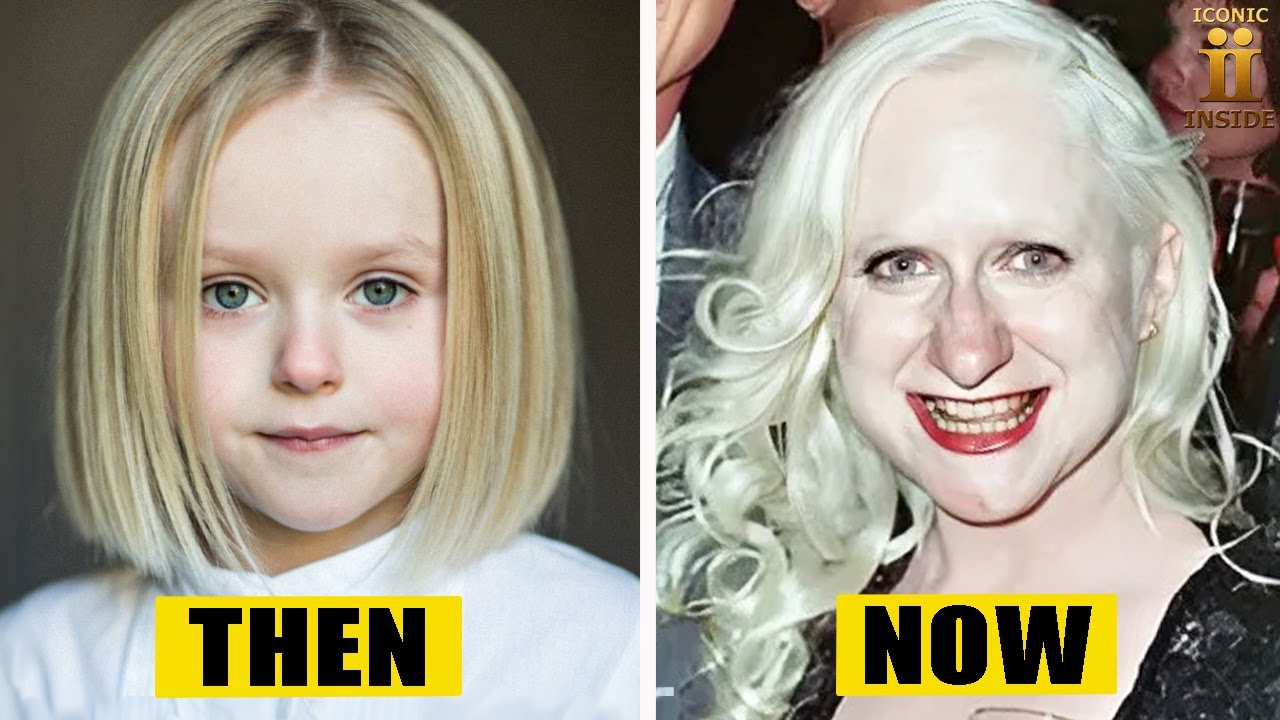 25 Child Celebs Who Aged Horribly Bad | Then and Now 2025