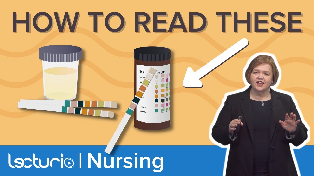 Объяснение цветовых кодов тест-полосок для анализа мочи – Med-Surg Nursing | Lecturio Nursing