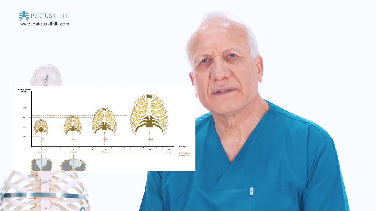Pektus Karinatum (Güvercin Göğüs) Hastalığı Nedir? Nasıl Tedavi Edilir? - Prof.Dr.Mustafa Yüksel