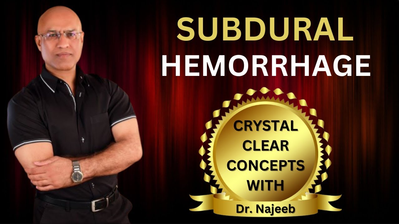Subdural Hemorrhage | Anatomical Correlation Clinical | Features And Pathophysiology