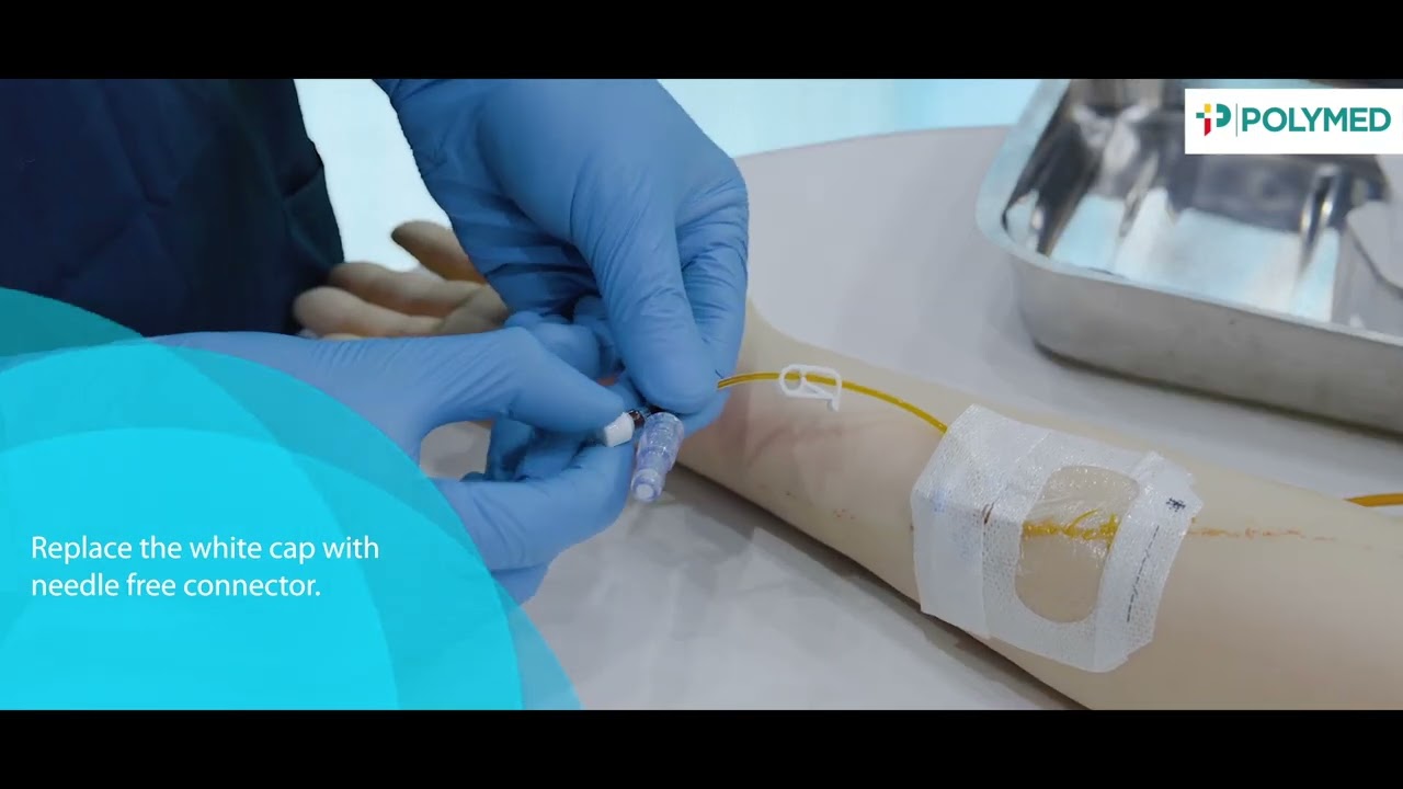 Nouvo Safety Set | Polymed