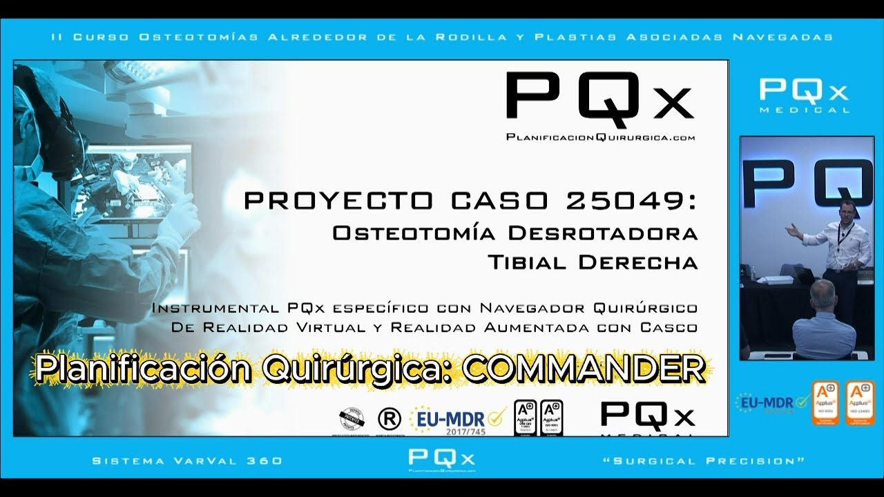Taller 7 Osteotomía Desrotadora Tibial + LPFM, con guías a medida navegadas YANKER y Navegador VEGA