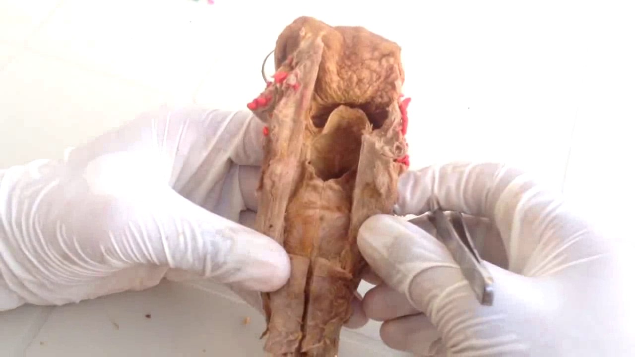 Anatom&iacute;a - Pr&aacute;ctica de Laringe (Cart&iacute;lagos, M&uacute;sculos, Inervaci&oacute;n, Irrigaci&oacute;n)