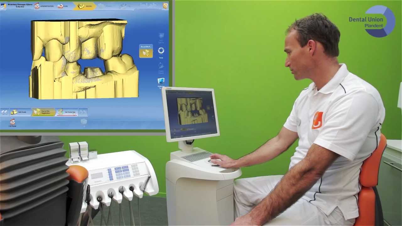 Ontwerp CEREC kroon in enkele minuten @ Dental Union