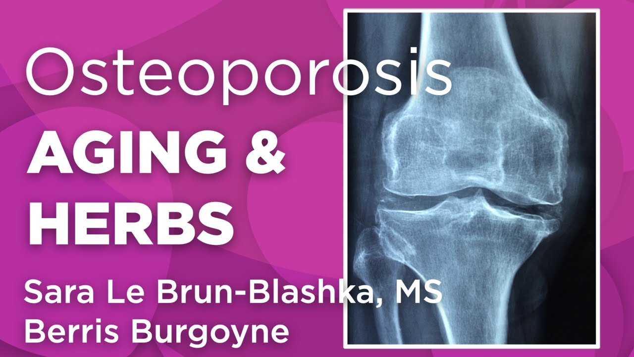 Aging, Osteoporosis, and Medicinal Herbs | WholisticMatters Podcast |Special Series: Medicinal Herbs