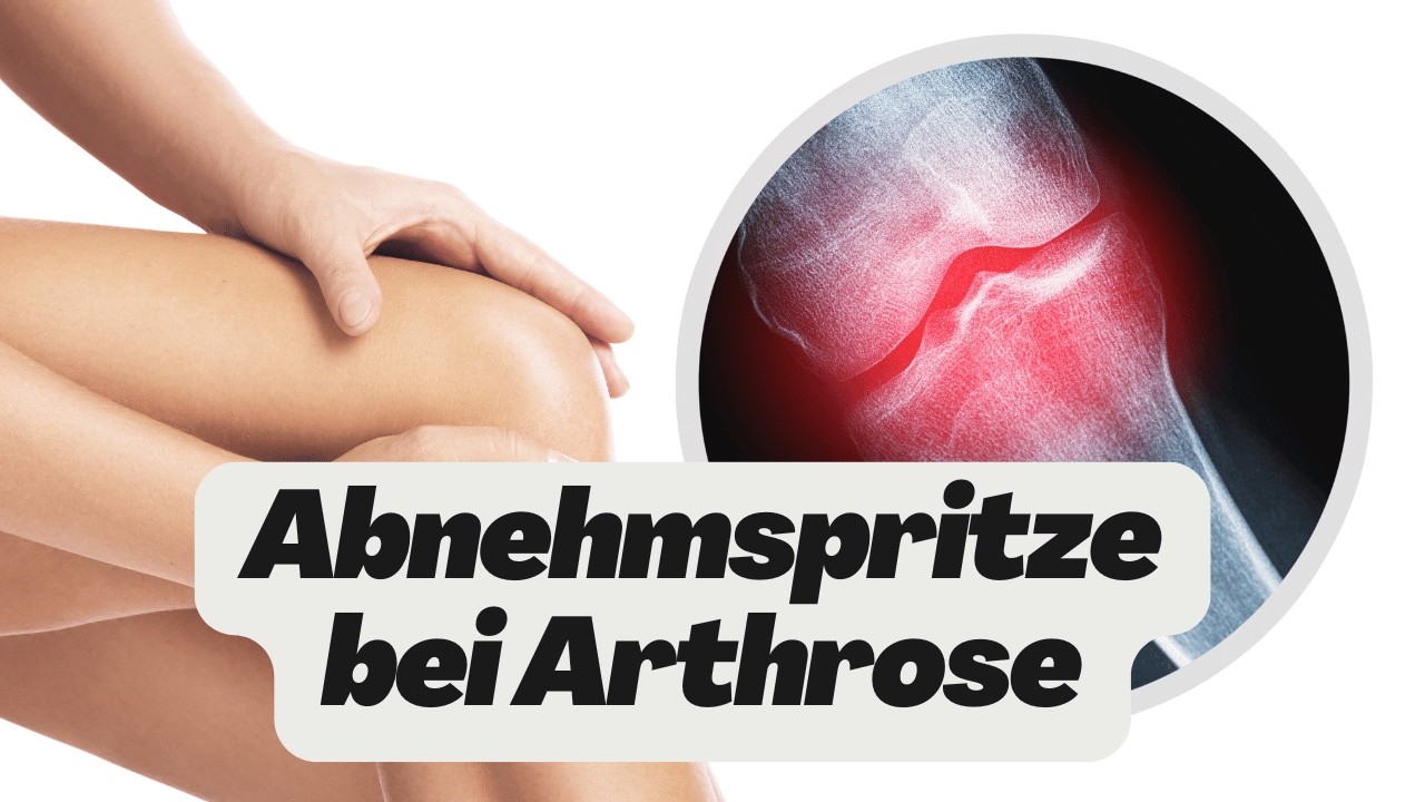 Was bringt die Abnehmspritze bei Arthrose? (Wegovy, Ozempic und Mounjaro)