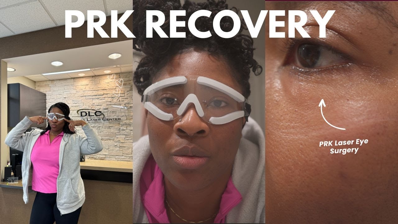 RAW| PRK Laser Experience: 7 Days Recovery