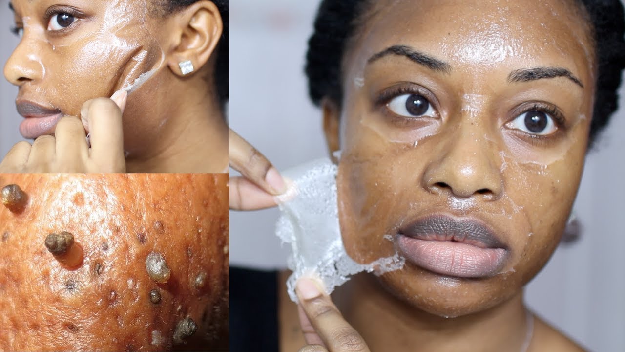 DIY Milk Blackhead Remover Peel Off Mask!