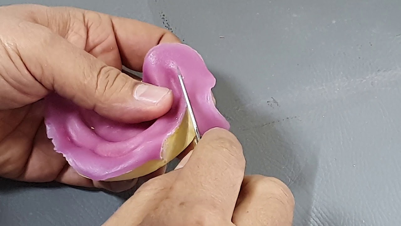 مختبر prosthodontics🦷 كيفية عمل Special tray باستعمال الاكريلك رايزن./كلّية الفارابي قسم طب الاسنان.