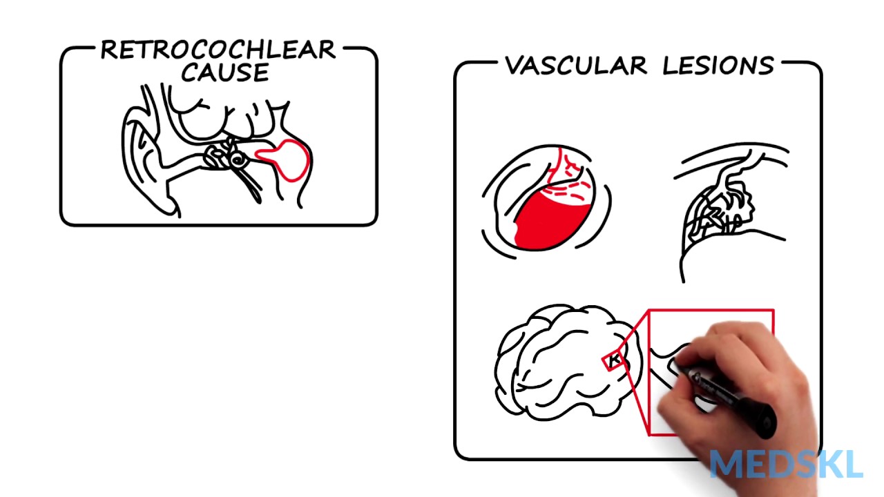 Ear, Nose, and Throat – Tinnitus: By Carol Bauer M.D.